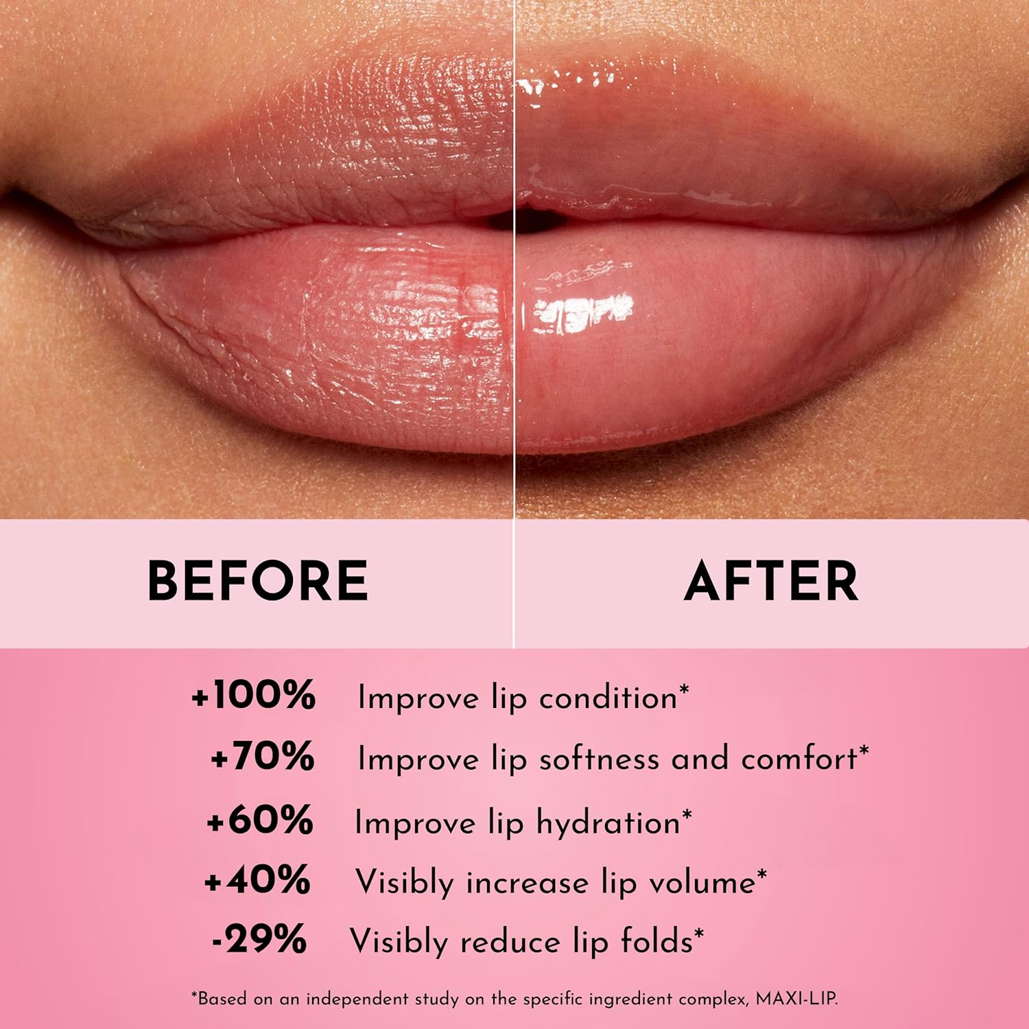 Forget the Filler Lip Mask - Image 5